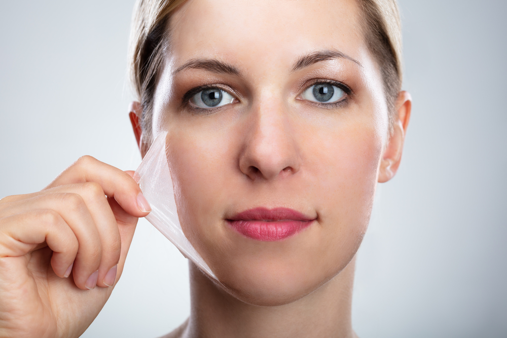 Advice for Before, During and After Chemical Peels | Beauty Now
